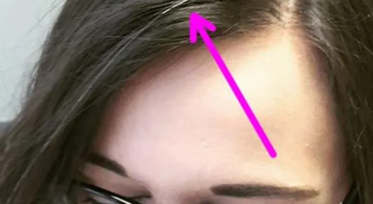 Póngalo en su shampoo y las canas desaparecerán para siempre. Para mujeres y hombres