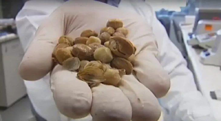 ¡Esta fruta elimina células tumorosas en minutos !