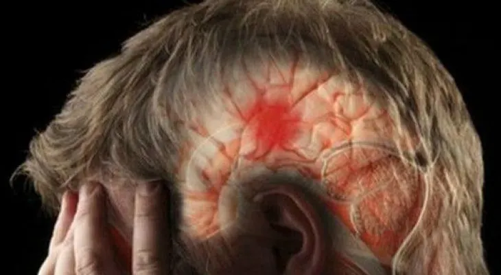 Mira los síntomas de derrame cerebral que quizás no conocías
