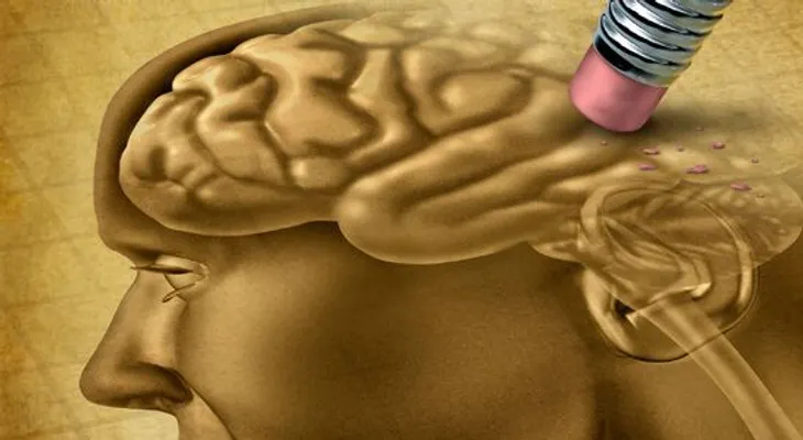 Mejorar la cognición es importante en casos de Alzheimer