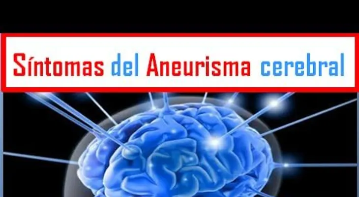 Que es una aneurisma, causa y consecuencia (VIDEO)