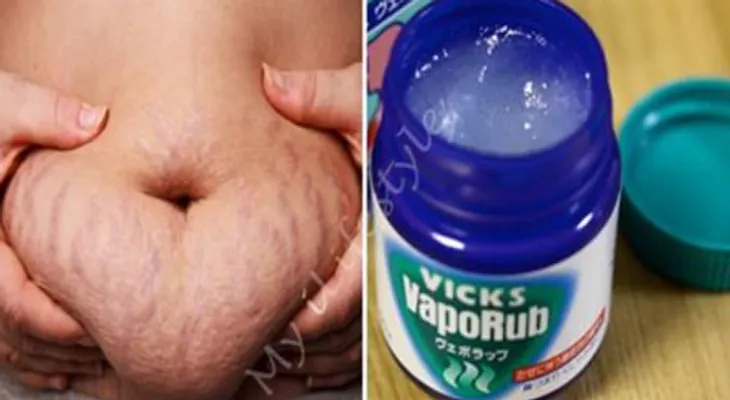 13 usos del VICKS VAPORUB que nadie te había dicho. Esto es increíble, porque no lo habían dicho antes