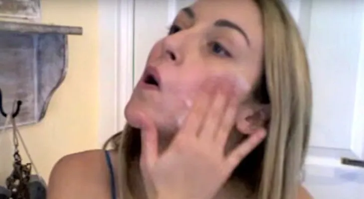 Tracy Kiss, de 28 años, tiene la sugerencia más rara de todas: tratar la piel con esperma cada día
