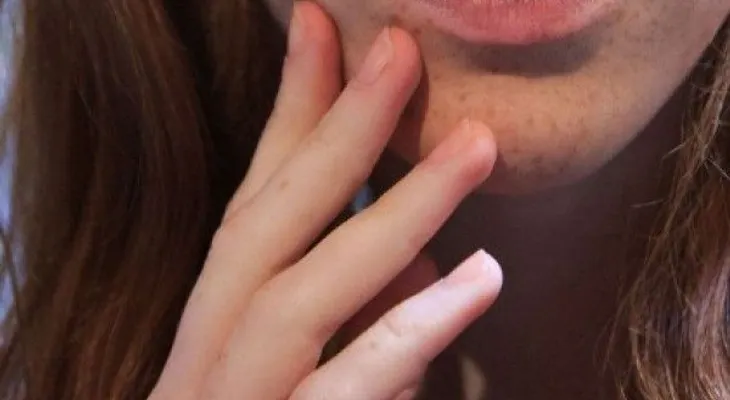 Tratamiento uñas quebradizas