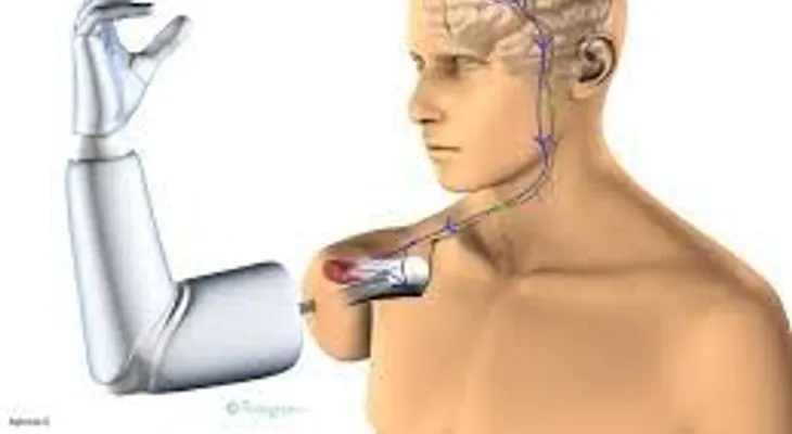 Utilizan novedosa tecnología para prótesis de rodilla en RD