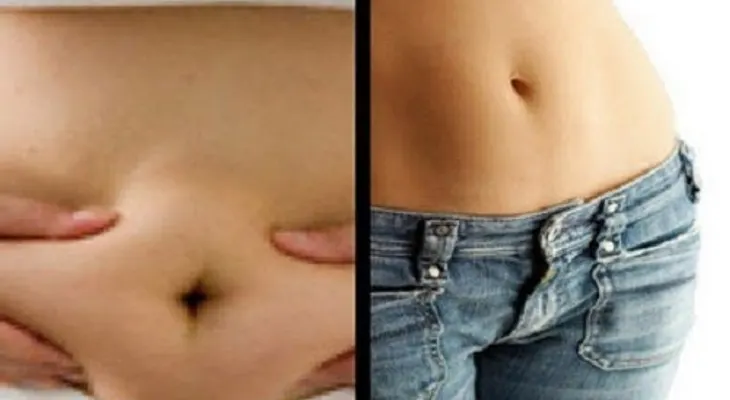 Un abdomen plano con bicarbonato de sodio en ayunas; ver opción 1,2 y 3