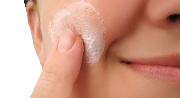 El descuido prematuro de la piel puede ocasionar el padecimiento del Melasma