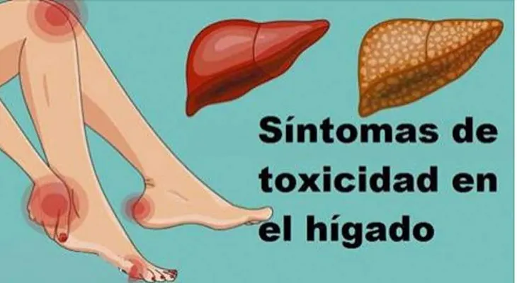 16 señales de que tu Hígado no está funcionando bien y las toxinas se están acumulando en tu cuerpo