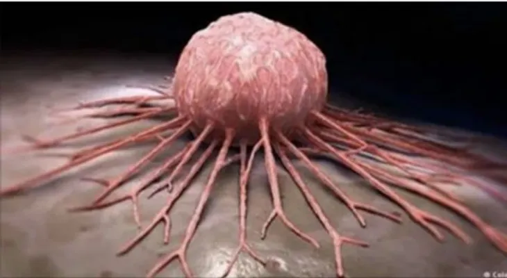 Un secreto ha sido descubierto: ¡El cáncer no es una enfermedad; solo es una carencia de vitamina B17
