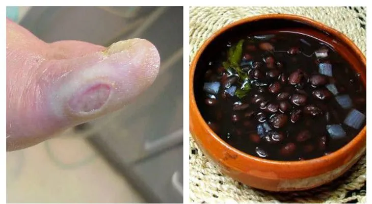 Conoce la antigua manera de tratar la DIABETES que los médicos constantemente ignoran?.