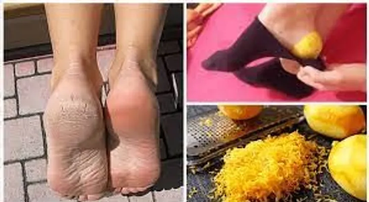 Nunca volverá a dormir sin una cascara de limón en los pies
