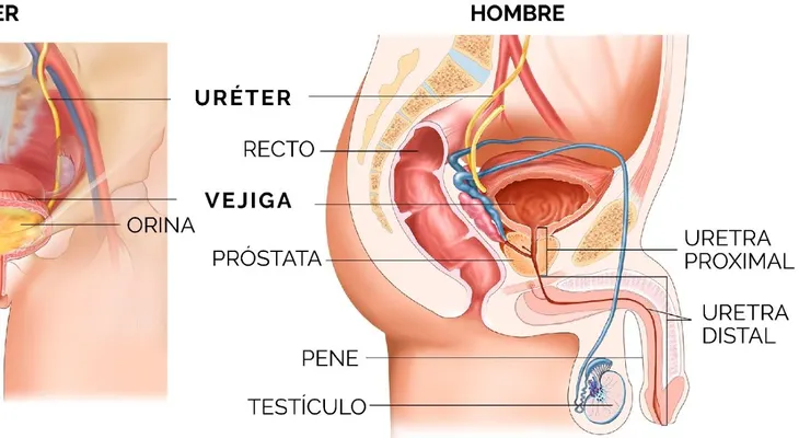 Estrechez uretral: cómo afecta la calidad de vida y por qué es clave el diagnóstico oportuno