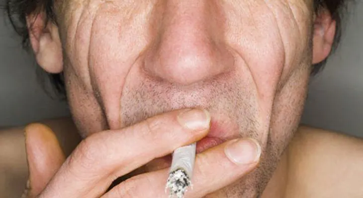 El rostro del fumador y sus daños muy notorios en la piel