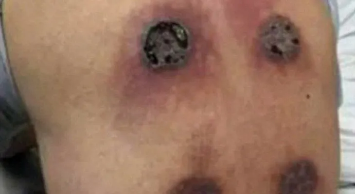 Este hombre se trataba el dolor en el hombro. ¡El resultado te dejará sin alientos!