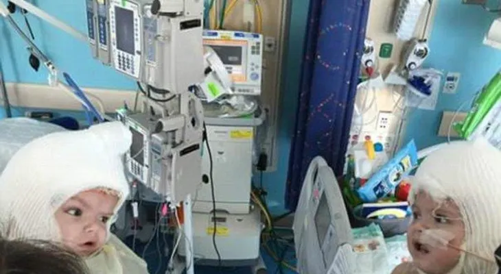 Gemelos separados se miran por primera vez