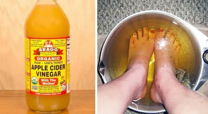 Asombrosos beneficios de sumergir los pies en agua caliente con vinagre de manzana durante 15 minutos