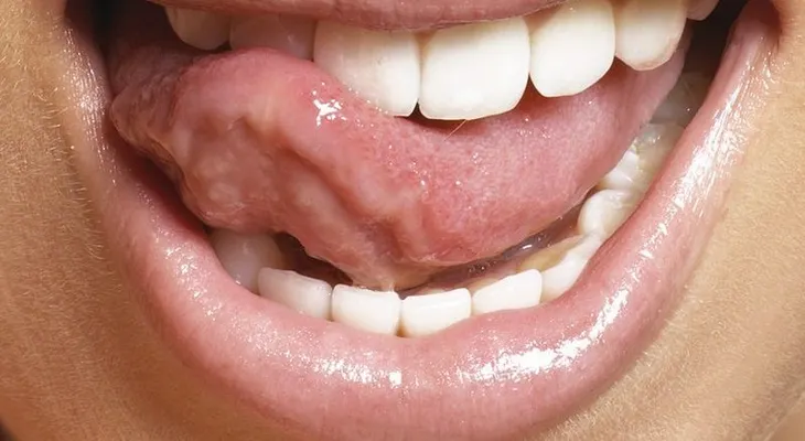 Mi abuela se aplicaba esto tres veces a la semana y hasta los 75 años no fue al dentista? 