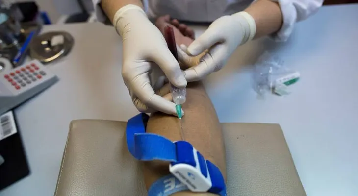  La prueba del Sida se podrá comprar en farmacias españolas sin receta médica 