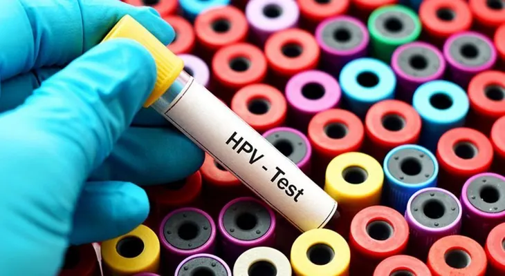 El 80 % de mujeres estarán infectadas de papiloma humano
