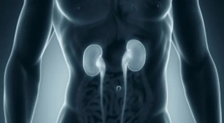Descuidar el riñón puede desencadenar en cáncer renal