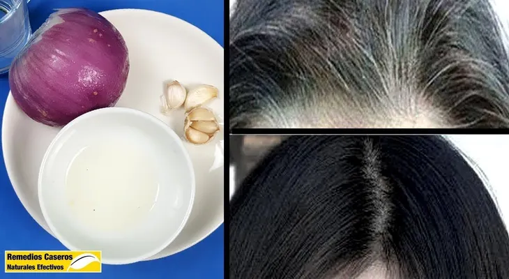Elimina todas las canas de tu cabeza con este jugo de cebolla