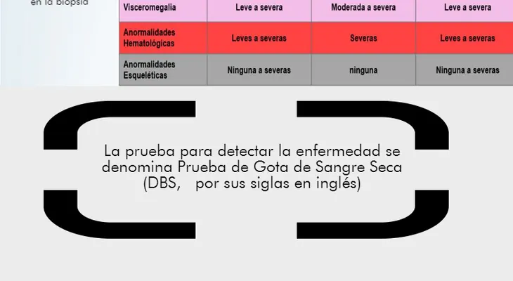Esperabas leucemia Es enfermedad de Gaucher