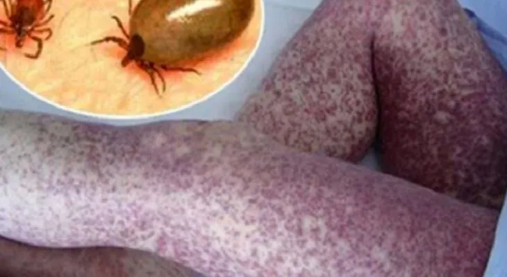 Estos son los peligros a los que te expones durmiendo con tu mascota