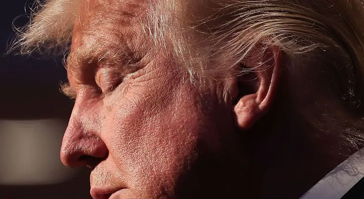 Trump está tomando medicina para la caída del pelo, dice su doctor