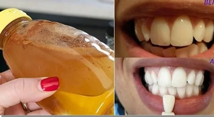 Haz gárgaras con este simple ingrediente y veras qué pasa a los dientes