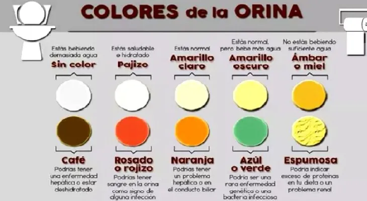 Descubre la enfermedad que puede tener con el color de tu orina