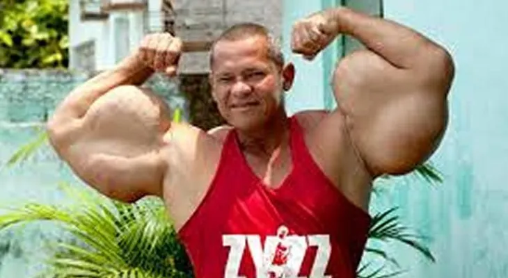 Vigorexia, cuando la obsesión por volverse cada vez más musculoso se convierte en enfermedad