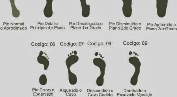 Ponerte zapatilla o calzado inadecuados mata tu pies