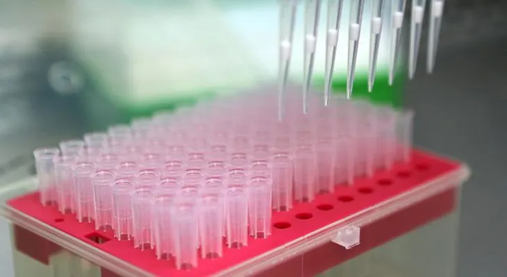 Más simple que nunca: descubren una nueva forma de diagnosticar el alzhéimer