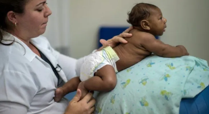 Zika: Bebés normales pueden desarrollar microcefalia el primer año