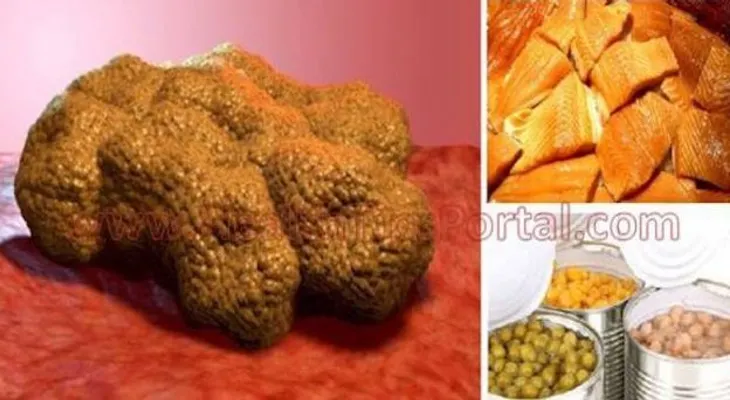 Estos son los alimentos que están causando cáncer en el MUNDO 