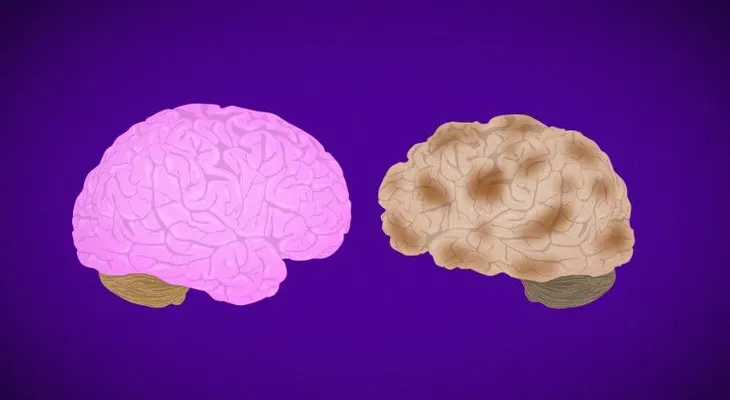 Investigación muestra un esperanzador fármaco contra el Alzheimer