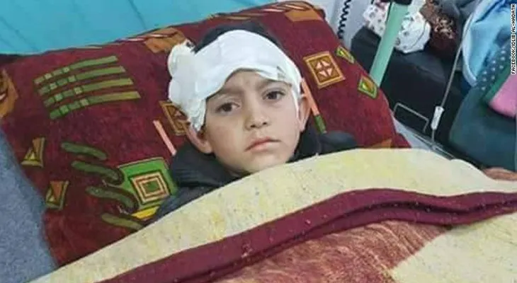 Un niño pierde sus piernas y ruega por la ayuda de su padre en la guerra siria
