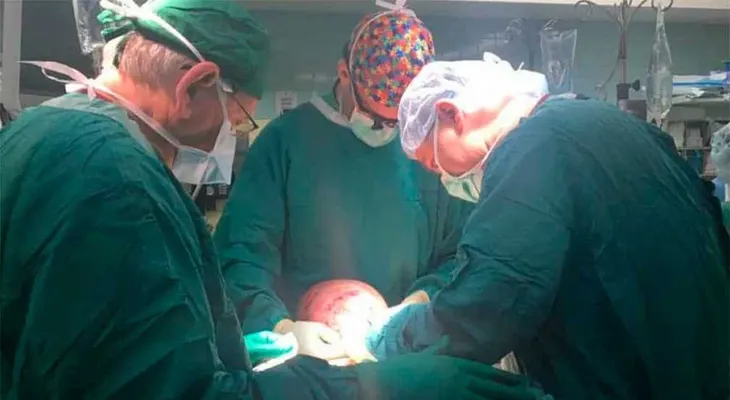  Muere niño cubano Emanuel Zayras, al que le extirparon un tumor de 4,5 kilos 