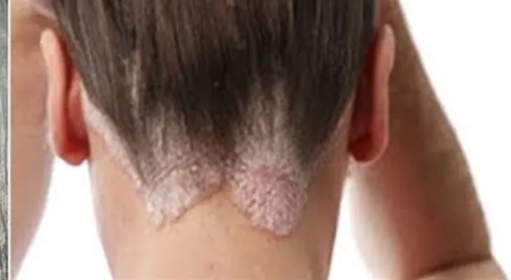 7 padecimientos que son causados por dormir con el pelo mojado