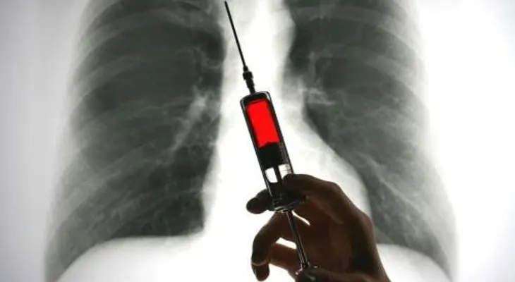 Diseñan una vacuna para prevenir cáncer de pulmón, intestino y páncreas