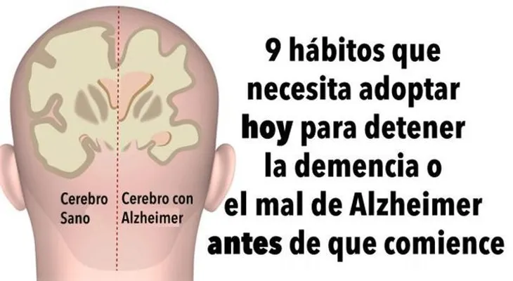 9 hábitos que necesita empezar para detener la demencia o el mal de Alzheimer 