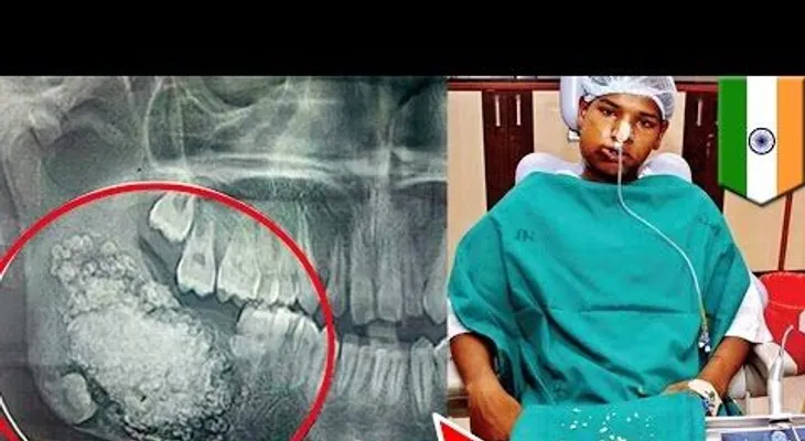 ¡Insólito! le sacan 232 dientes a joven