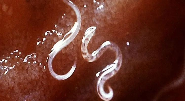 Los científicos quieren usar gusanos parásitos para tratar con éxito la esclerosis múltiple...