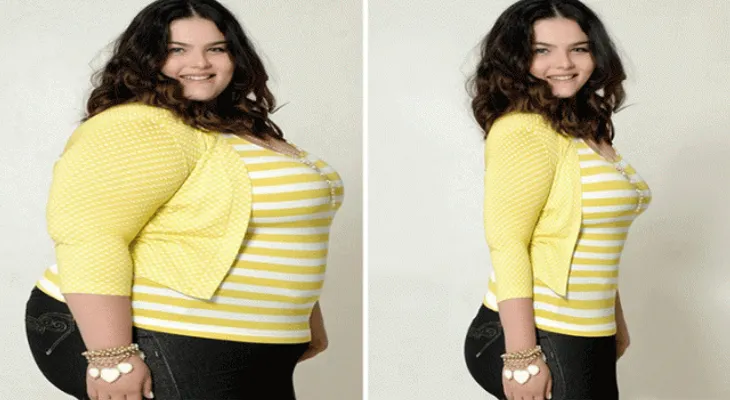 Usó este remedio para rebajar y quedó como una modelo