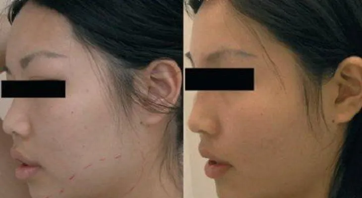 Beneficios de tener un rostro más estatizado