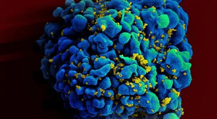 Nueva terapia para luchar contra el VIH y la hepatitis C