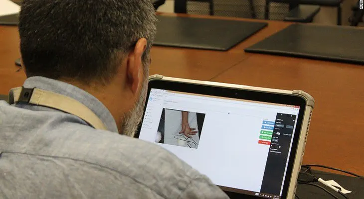 Doctor usa iPad para realizar cirugía a distancia en Gaza