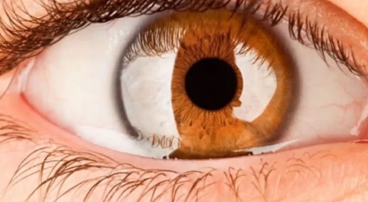 ¡Pendiente! La salud ocular también requiere cuidados