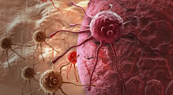 ¿Por qué hay cada vez más casos de cáncer? 3 posibles razones