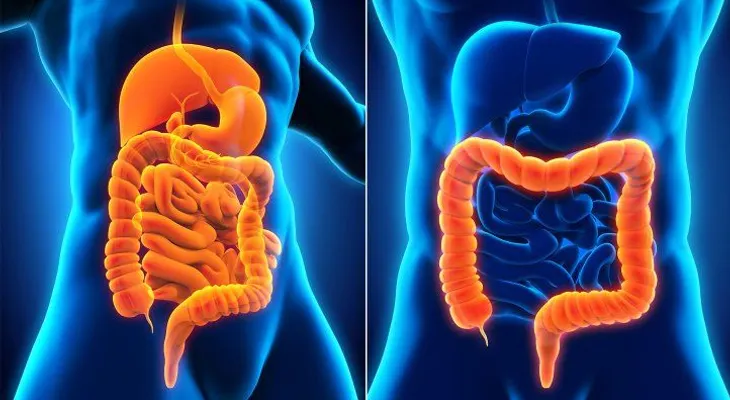 Colitis ulcerosa: ¿Cuáles son sus síntomas y causas?